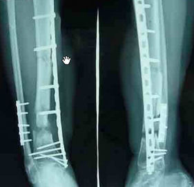 Good price Hastane İçin Tıbbi Kağıt Lazer Yazıcı X Ray Teşhis Görüntüleme çevrimiçi