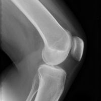Good price Yüksek Netlikli Xray Filmler çevrimiçi