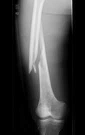 Good price Konida Laser X Ray Tıbbi Görüntüleme çevrimiçi
