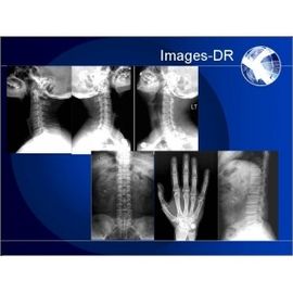 Good price Esnek UC Kollu Mammogrpahy X-RAY Dijital Radyografi Makinesi çevrimiçi