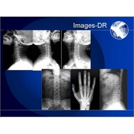 Esnek UC Kollu Mammogrpahy X-RAY Dijital Radyografi Makinesi