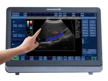 Good price 15 inç LED Monitör ile Taşınabilir Tıbbi 3D / 4D Renkli Doppler Ultrason Sistemi çevrimiçi