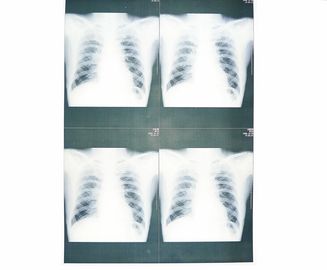 Good price Sony / EPSON Lazer Yazıcı için Beyaz Bankası Tıbbi X Ray Kağıt Filmi Moistureproof çevrimiçi