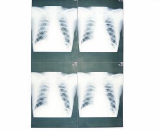 Sony / EPSON Lazer Yazıcı için Beyaz Bankası Tıbbi X Ray Kağıt Filmi Moistureproof