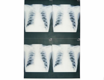 Sony / EPSON Lazer Yazıcı için Beyaz Bankası Tıbbi X Ray Kağıt Filmi Moistureproof