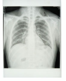 Good price PET malzemeler ile özel 25cm * 30cm Beyaz Taban Xray Kağıt Tıbbi Film çevrimiçi