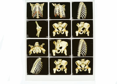 Giyilebilir Beyaz Taban X Ray Teşhis Görüntüleme, Tıbbi Lazer Mavi X Ray Filmi