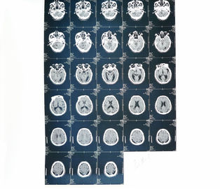 Hastane İçin Tıbbi Kağıt Lazer Yazıcı X Ray Teşhis Görüntüleme