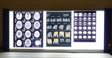 Good price Termal Yazıcılar KND-F için 10in * 14in Dijital x-ray Kuru Tıbbi Görüntüleme Filmleri çevrimiçi