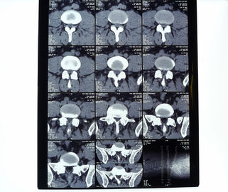 Good price Beyaz PET AGFA Tıbbi Kuru Film çevrimiçi