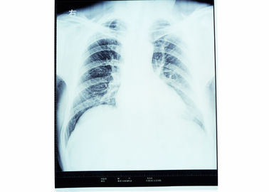 Fuji Yazıcı için 10 x 14 X-ray Tıbbi Kuru Görüntüleme Filmi Duyarlı Termal