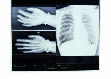 Tıbbi Görüntüleme X Ray Kuru Film 14 x 17 Konida, Yüksek Yoğunluklu