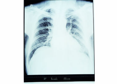 Good price AGFA 5300/5302/5500 KND-A için Tıbbi Kuru Görüntüleme Filmi X-ray çevrimiçi