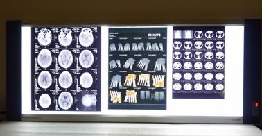 Parlak Tıbbi X Ray Kuru Termal Yazıcı Filmi Lazer Mavi Baz