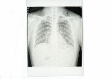 Beyaz Tıbbi Kağıt Göğüs Röntgen Filmi Suya Dayanıklı Yüksek Netlik
