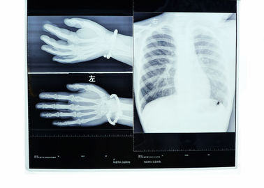 Good price Düşük Sis 14in * 17in Tıbbi Görüntüleme Kuru X-ray Şeffaflık Termal Yazıcı Filmi çevrimiçi