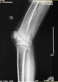Good price AGFA 5300, 5302, 5500 Üzerinde X Ray Muayenesi için KND-A Düşük Sisli Tıbbi Kuru Görüntüleme Filmi çevrimiçi