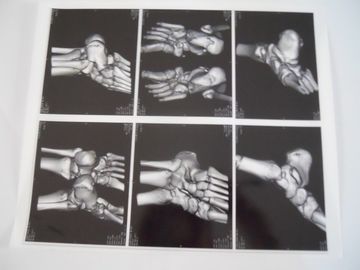 Good price AGFA 5300, 5302, 5500 Üzerinde X Ray Muayenesi İçin Tıbbi Kuru Görüntüleme Filmi çevrimiçi
