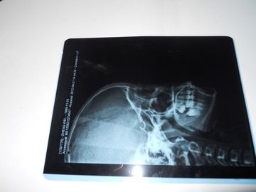 Good price AGFA 5300'de X Ray Muayenesi için KND-A Çevre dostu Tıbbi Kuru Görüntüleme Filmi çevrimiçi