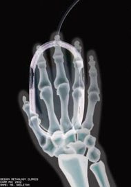 Şeffaflık Kuru Tıbbi Görüntüleme Filmi, Agfa Termal Dijital Röntgen Filmi