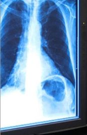 Mavi Tıbbi Kuru Görüntüleme Filmi, 11in x 14in Lazer Fuji X Ray Filmi
