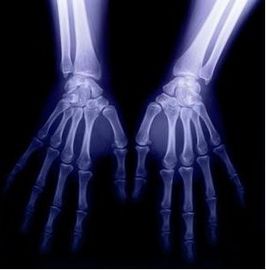 Good price Dijital Tıbbi Tanı Görüntüleme, 8 x 10 CT X-ray Kuru Film çevrimiçi